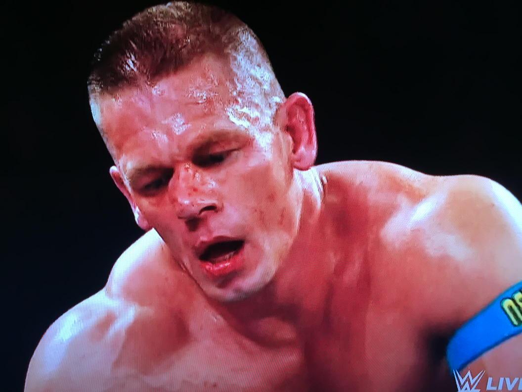 John Cena foi operado de urgência ao nariz