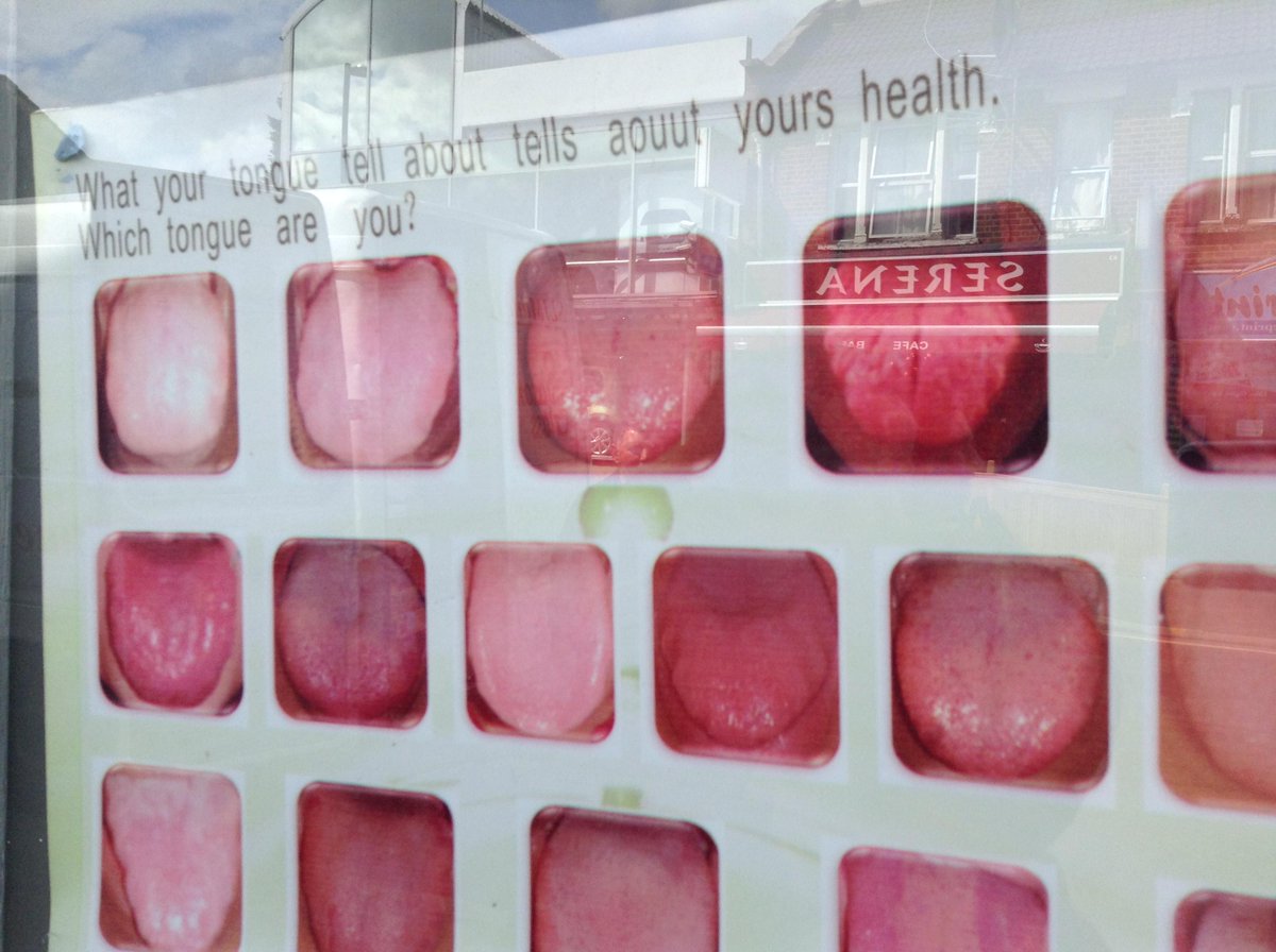 RedRawFletch's tweet photo. #walthamstowstreetphotos #walthamstow
Which Tongue Are You?
Hoe Street http://t.co/ceOQWj4P3u