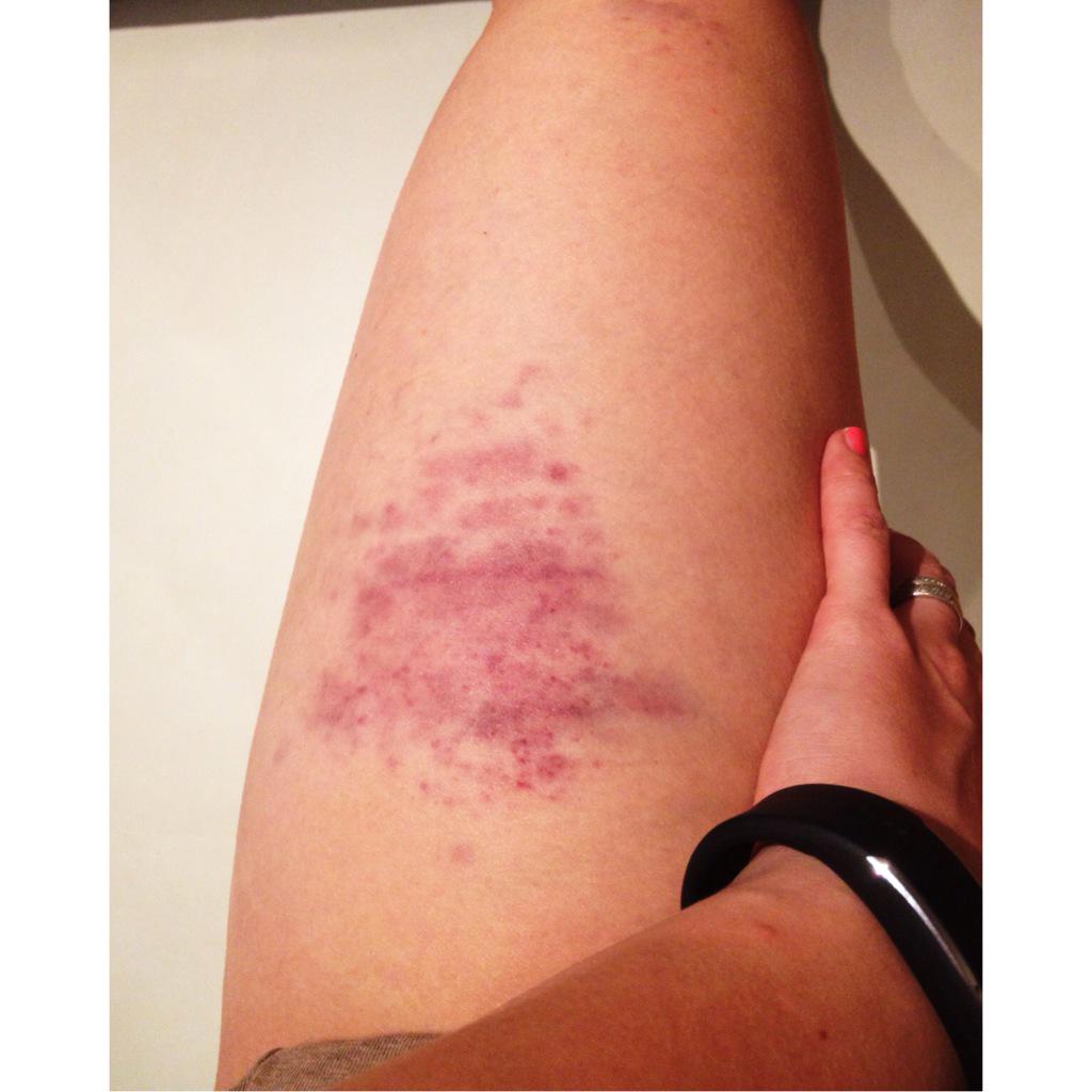 elinaarlin's tweet photo. Little #bodypercussion never killed nobody... But it might hurt little bit! http://t.co/so9oMSG8Bg