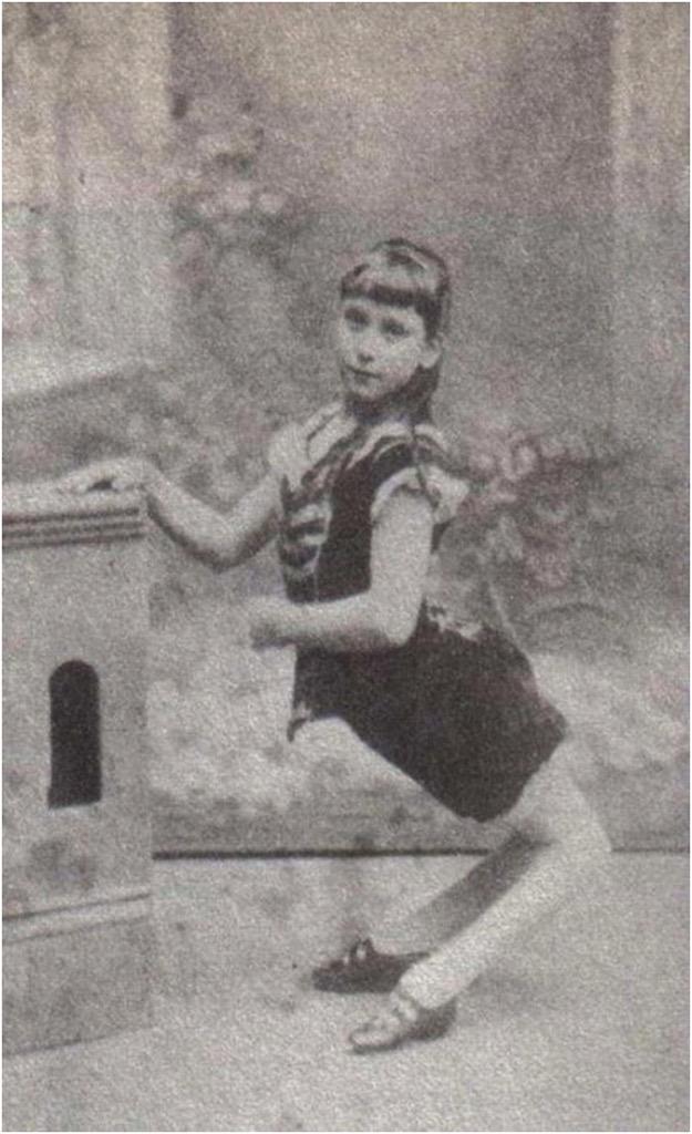 SeriousStrange's tweet image. Ella Harper was born in 1873 with congenital genu recurvatum, a condition which caused her knees to bend backward.