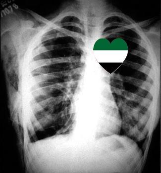 Nuestro corazón siempre sera Extremeño