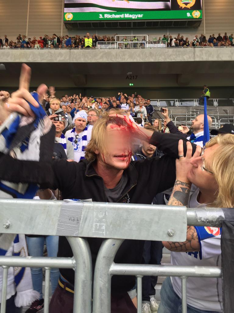 Vakternas reaktion på att en person står i närheten av pyro. Öppet sår i huvudet och ingen sjukvård här efter 10 min.