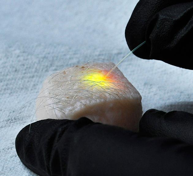 Nature's tweet photo. Oil droplets turn cells into tiny lasers http://t.co/CTwzCWiFU4 http://t.co/aRzCNuQHTh