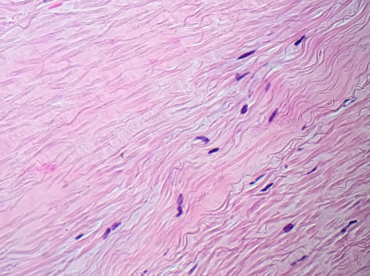 pathtutor_com's tweet image. Ligamentum flavum H/E+trichrome+elastic @JMGardnerMD @syntheslide @mvmd0908  #pathology #histology #medschool