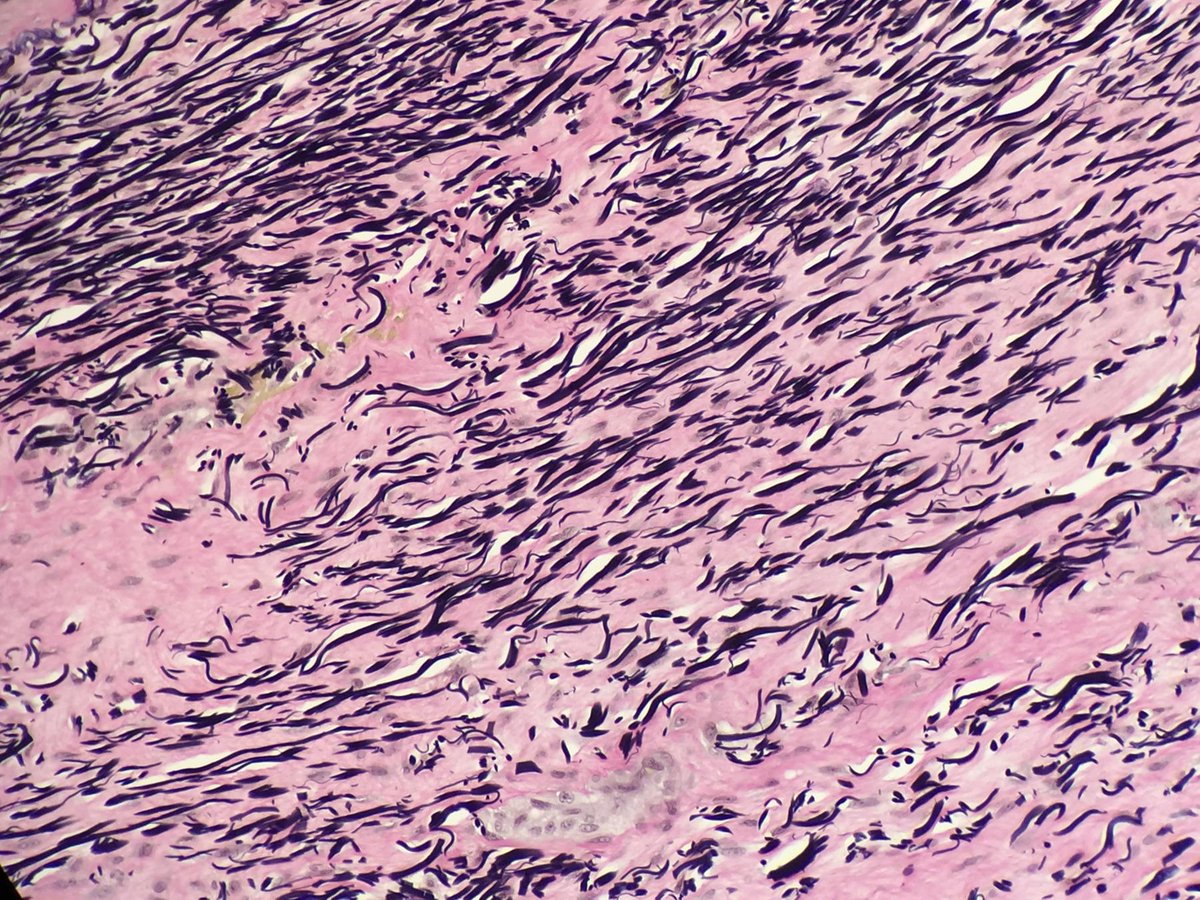 pathtutor_com's tweet image. Ligamentum flavum H/E+trichrome+elastic @JMGardnerMD @syntheslide @mvmd0908  #pathology #histology #medschool