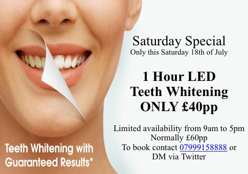 SurrealSmiles's tweet photo. We have 2 appointments left in the afternoon for our £40 Saturday offer 🙌 text 07999158888 to book your space! http://t.co/ESiWMatyRx