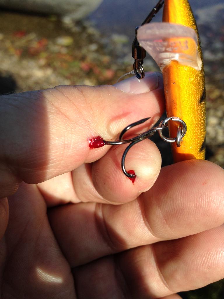 Lucasdp33's tweet photo. Atta boy luch you're a trooper http://t.co/UC8UpV5gaZ
