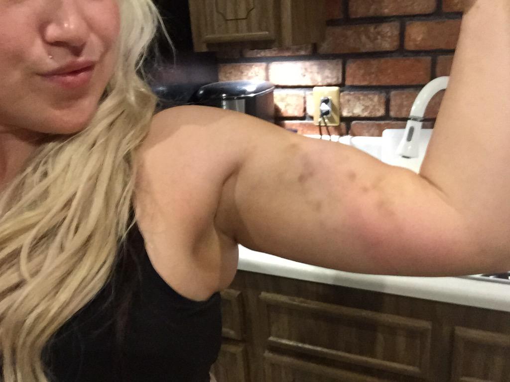 IamNikkiPhoenix's tweet photo. Did my 1st Roll up 2day in #aerialstrap class w/@FlyingDreamsLV it was awesome, battle wounds 2 prove it. #beastmode http://t.co/AM3Jub1leN