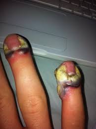 xysybidysoji's tweet image. Shocking Sex Facts You Never Knew About ! Side Effects Of Fingering All Girls Must see =&amp;gt;&amp;gt;bit.ly/1KIlZVk