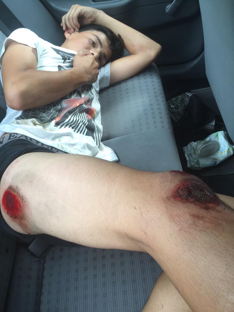 a_ramos_mando's tweet photo. Today was a bad day for my brother #fall #wubblessucks #ciales #candyhill #product http://t.co/DqVbkxB2PQ