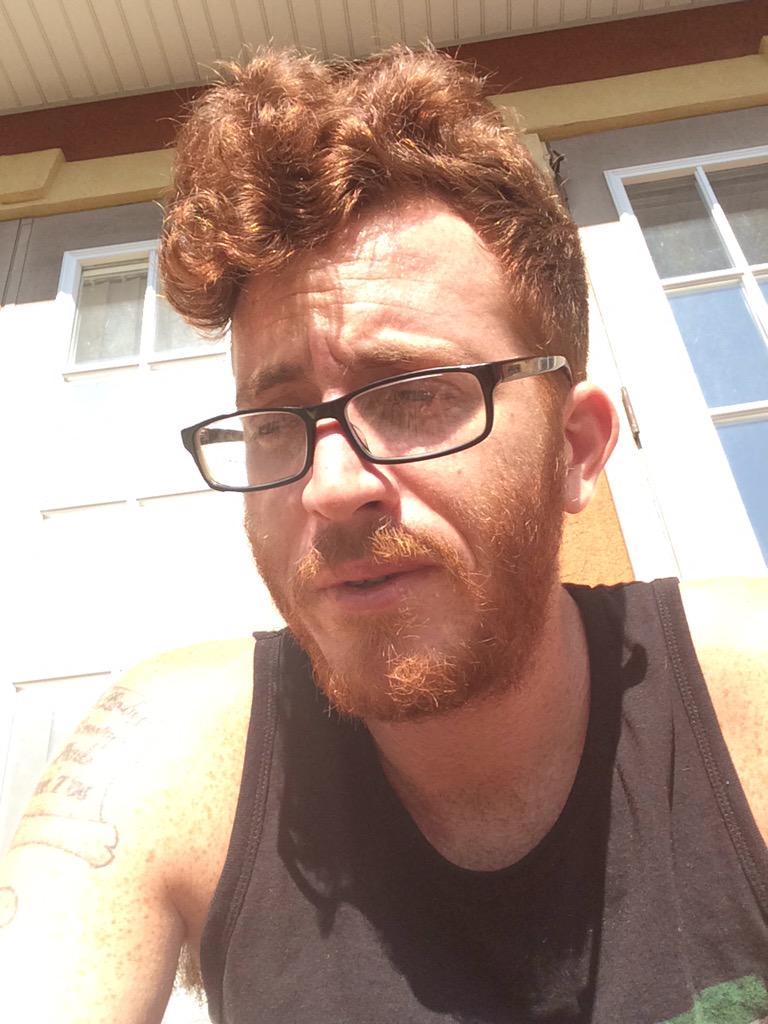 imoldgreg239's tweet image. Sun bum skin. @TrustTheBum #sunbum #tanlife