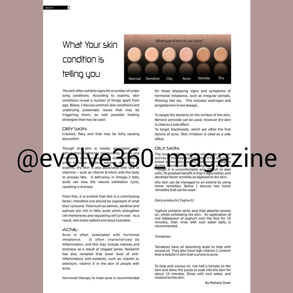 evolve360_mag's tweet photo. Dry skin, Oily skin or Acne? Find out what is your skin condition telling you in this month's issue #health http://t.co/ZDROmj707E