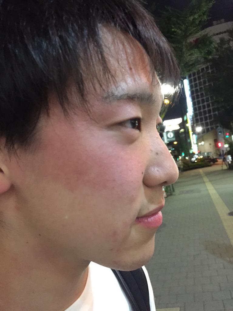 だいすけ この人鼻から上だけ赤いw Http T Co Zprfvgbyhj