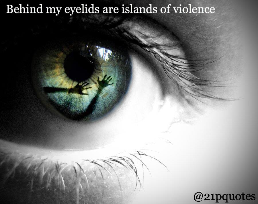 Migraine