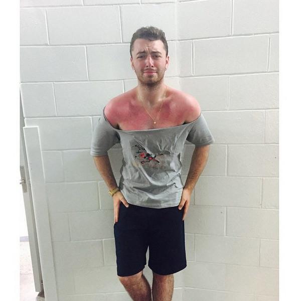 XecDes's tweet image. Sam Smith Gets Sun Burn.