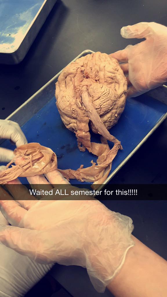 makeitAPC's tweet photo. Tonight's amazing class holding a brain! #brainpower #student #medicine http://t.co/c8sKULILvU