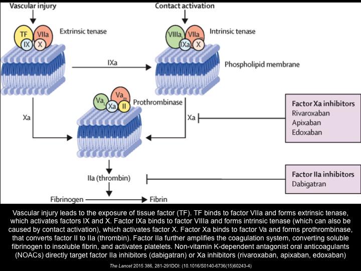 Schematic representation of coagulation system and site of action of NOACs #Lancet