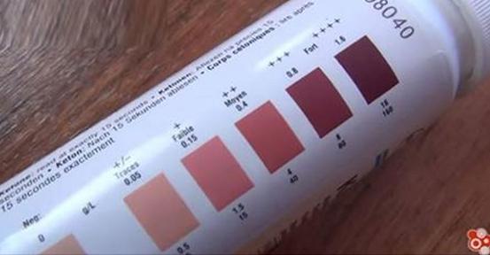 Know about ketones? Ketones are an acid remaining when the body burns its own fat: bit.ly/1OwEKKf #DOC