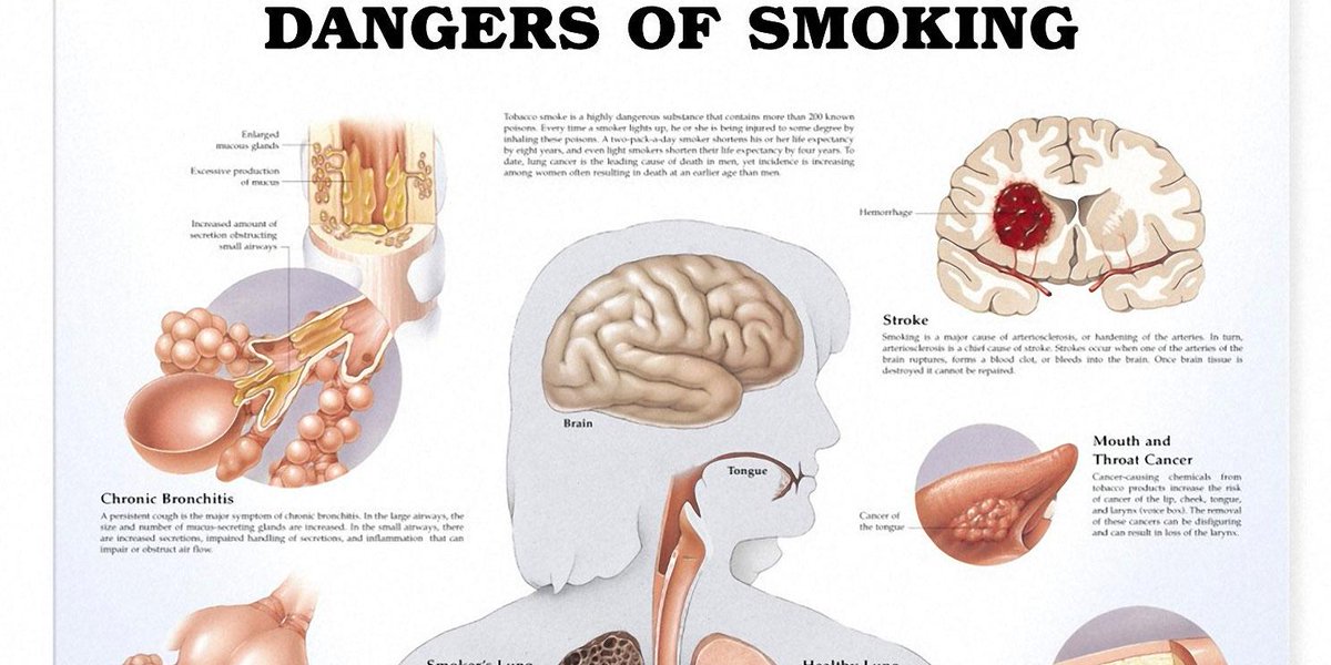 AHealthBlog's tweet photo. Smoking Prevalence in US Decreases http://t.co/ljM7vuft8Z http://t.co/pnxfERsEmH