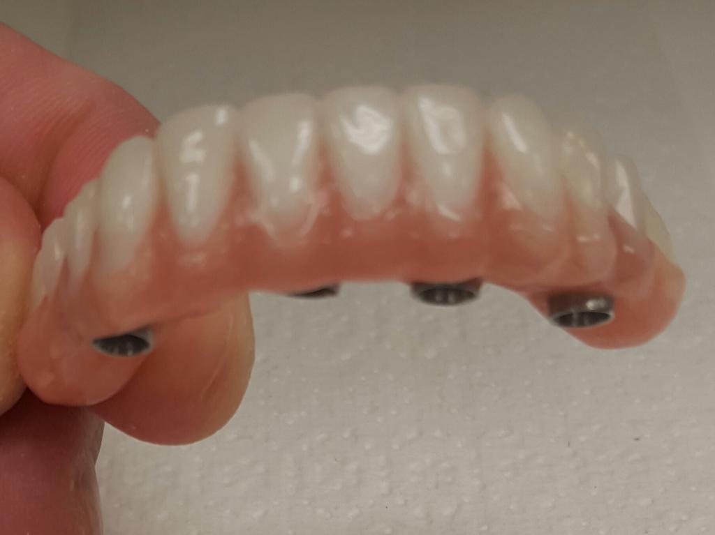 Affordable Dentures Rochester Mn Phone Number  - Determine Location By The Phone Number Online.