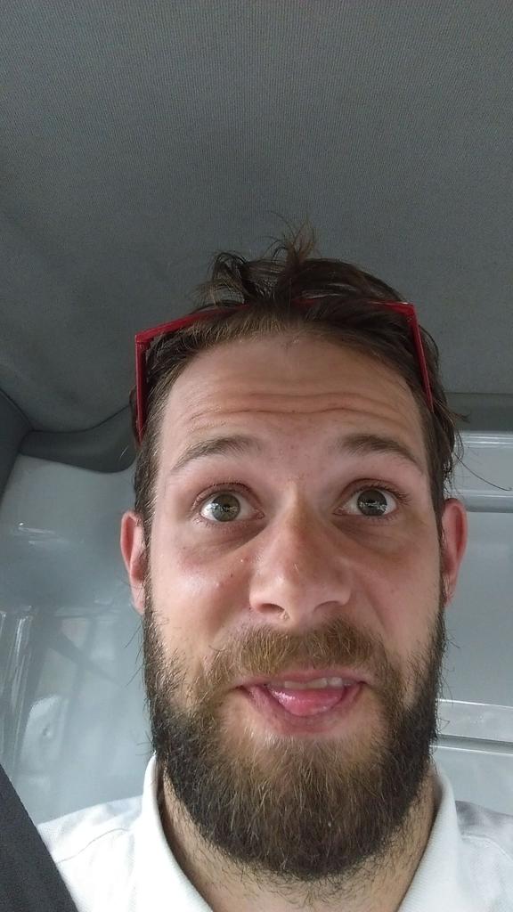 When your a white boy with a black man nose #racistbanter