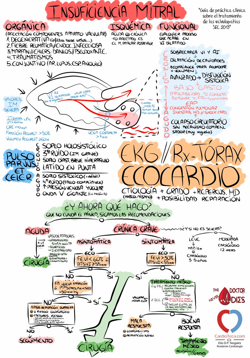 cardioteca's tweet photo. #Resumiendolaguía Insuf. Mitral, lo que los #Resiscardio deben saber: Dx, Valores ECO, cómo trato? opero? ¡Ánimo! :D http://t.co/QrUPbqC9Zi