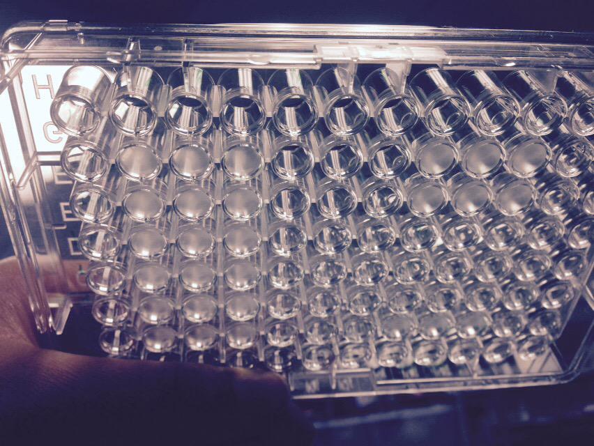materechm's tweet photo. @materechm @PerlsteinLab better picture. 24h later you can clearly see the difference in all wells http://t.co/c8bztOrNCY