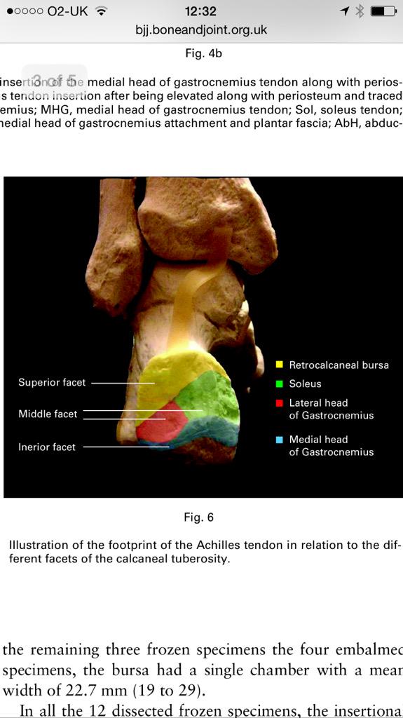 Seth0Neill's tweet photo. Bony insertion of Achilles' tendon #lovelyimage #tendinopathy http://t.co/eLUkmeB1Ud