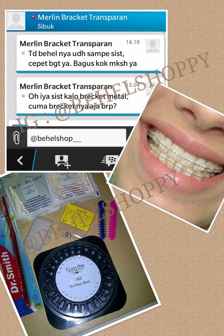 BehelStoreID's tweet image. HOTPROMo
Behel Permanen Transparan
dr 650rb -&amp;gt;cuma 300rb 😍

lengkap tinggal bwa kdokter
Pin 328498a7 
wa 08981060123
