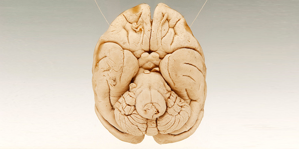 Nature's tweet photo. Comparing monkey &amp; human brain responses to abstract info finds what makes humans unique http://t.co/VL0XRxxvC2 http://t.co/QkrRzY1qRM