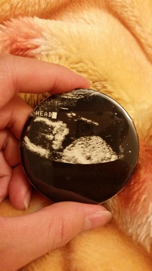 citruscalvin's tweet photo. It says "head" in case people didn't know what my head looked like #alienfetus http://t.co/3nGZ6jQUez