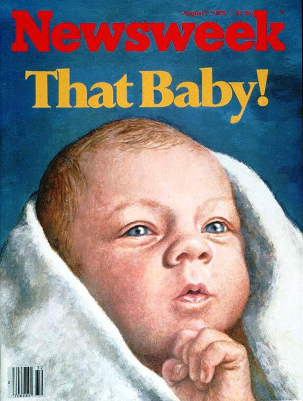 Happy birthday Louise Brown 1978 the world\s 1st test tube baby (IVF) was born. 