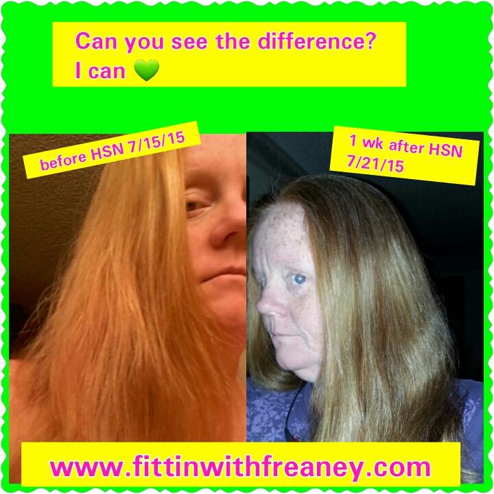 StephFreaney's tweet image. It works HSN!  Hair skin nails... 6 days of use and my hair looks amazing