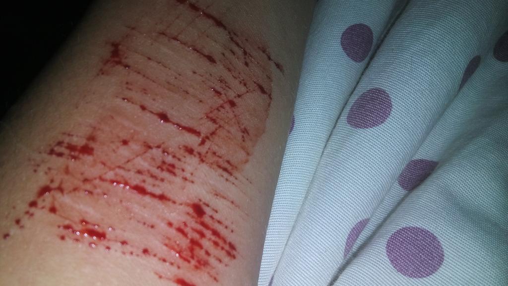 poxa_gab's tweet photo. Carrego nos pulsos toda vez que desejei estar morta! 😞💔 http://t.co/n6eiIpFcRl