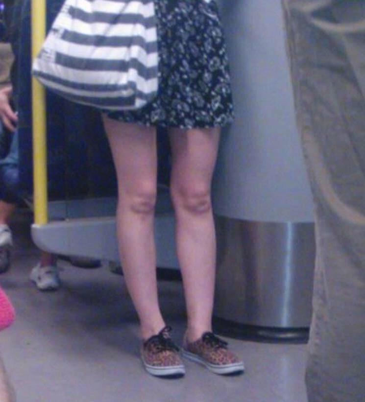 Poshboy97's tweet photo. Her knees look like Phil Mitchell http://t.co/eZMh7hFsr4