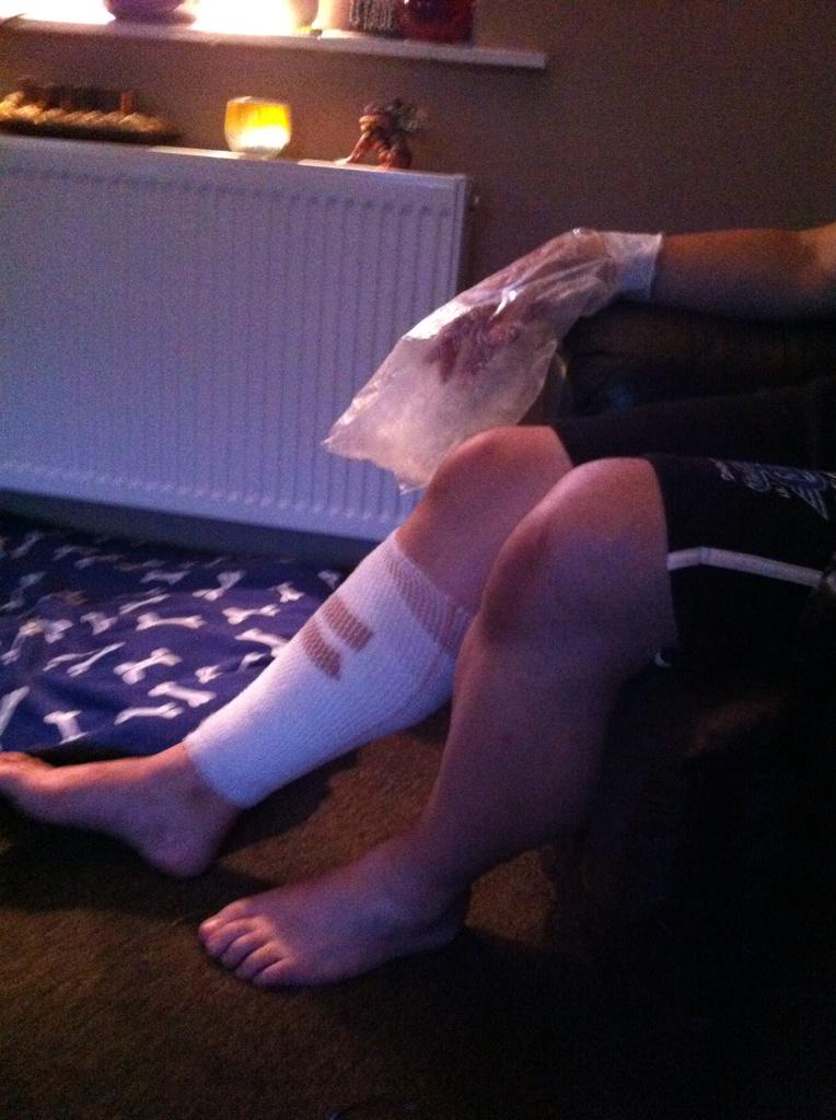 Valuable lesson learned, petrol + fire = roll on floor to put our your leg and hand :( #stupid idiot