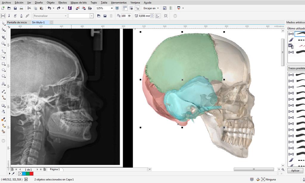 nathalia5476's tweet photo. @NeuroFUNJC #neuro3 #Radiología #3D @GeralRocha_ @lauracamrodrig1 @CamiiloRodriigz @lizzeth1097 http://t.co/mocz3MCtJi