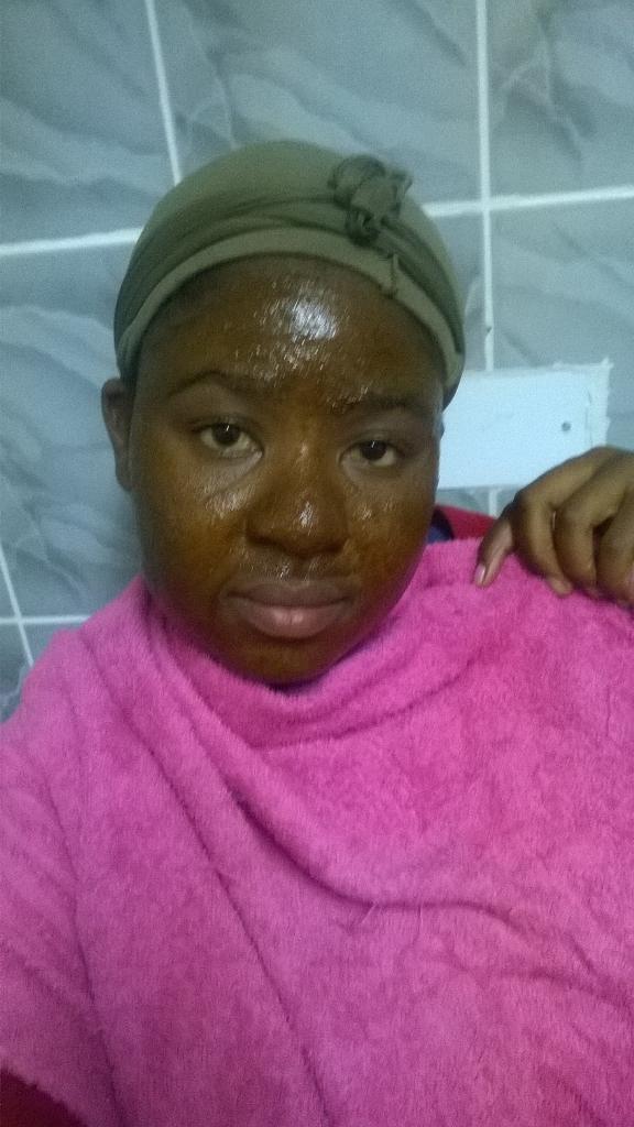 MantyPMadziba's tweet image. #currentSituation
#PimplesTreatment
#GoingNatural
#Honey,Lemon&amp;amp;Cinnamon paste
 ke itsaa serious dem gals r vry tricky