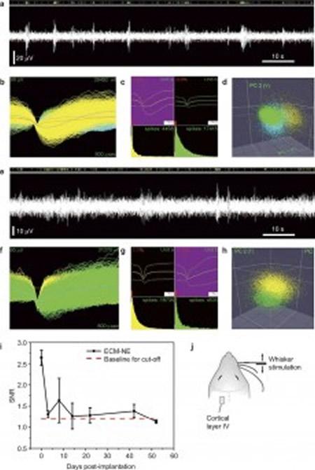NeuroscienceNew's tweet photo. Brain Friendly Interface Could Change the Way People with Spinal Cord Injuries Live http://t.co/gvmW60AnUz http://t.co/78VrK7WSVv