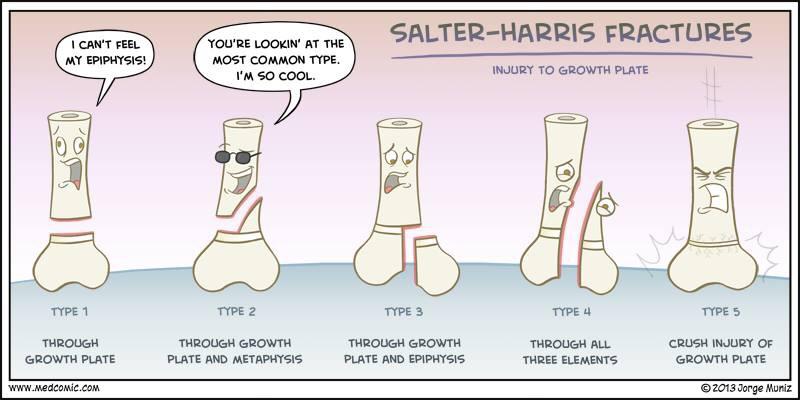 DW8674's tweet photo. #nursingsummerschool - Salter-Harris Fracture Classification. @BedsNursing http://t.co/8zoRkBAKUr