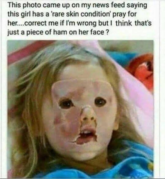 Ham Face Girl