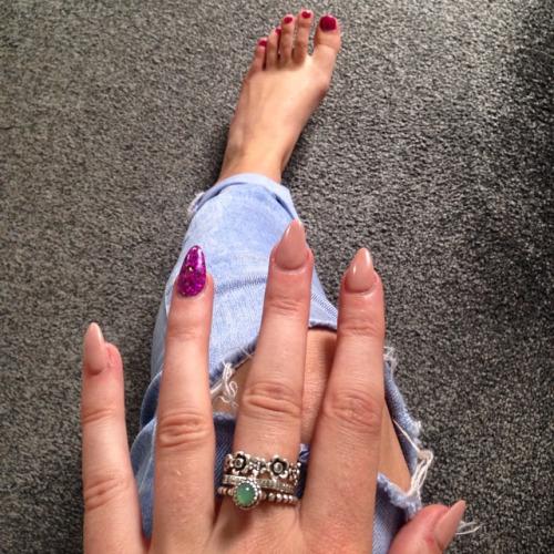 _Acrylic_Nails's tweet photo. #holidaynails #pretty #2daystogo #acrylicnails #shellactoes... http://t.co/fGuLp5A7CD #acrylicnails #nailart http://t.co/0EoGTTpOvg