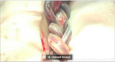 haracazirowo's tweet photo. Mom Expected Normal Twins, But When the Doctors See This, She's SHOCKED => http://t.co/6K93AXiYTl http://t.co/HtLvWomjNR