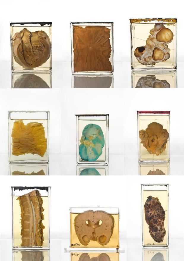PastMortems's tweet photo. Great pieceby @AnniSkilton on @deadmaidens blog: "Recording the Diseased &amp; the Deceased" http://t.co/QaFjdc0SsF http://t.co/XKiUGvHwUX
