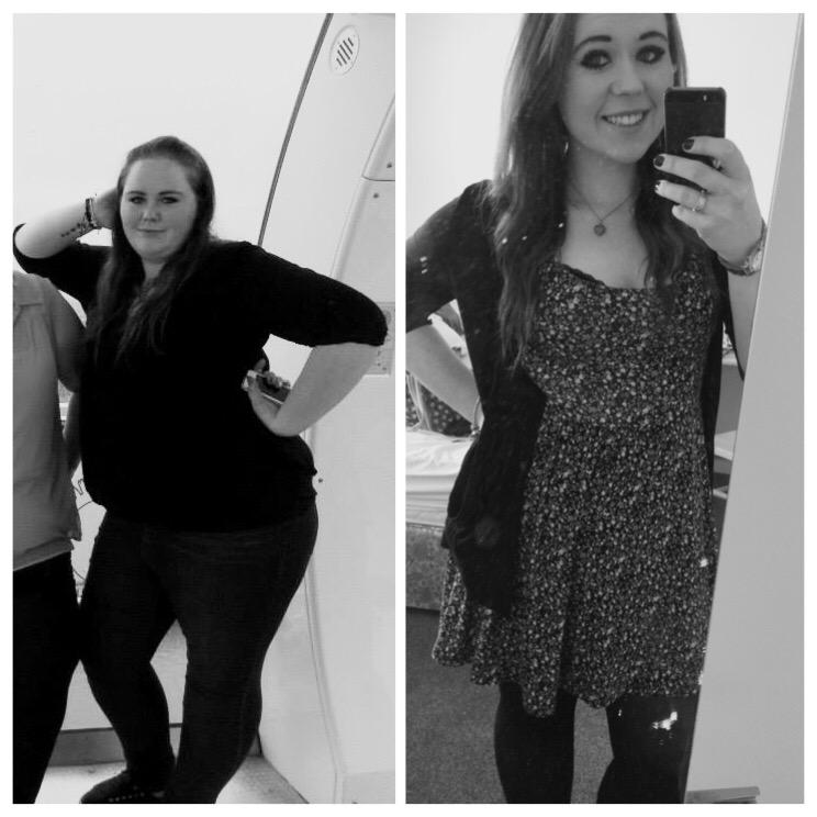 jessjess003's tweet photo. @SlimmingWorld 7 stone 9 lbs gone in just over a year 👍🏻 #SlimmingWorld #transformationtuesday http://t.co/hFn77XFEpW