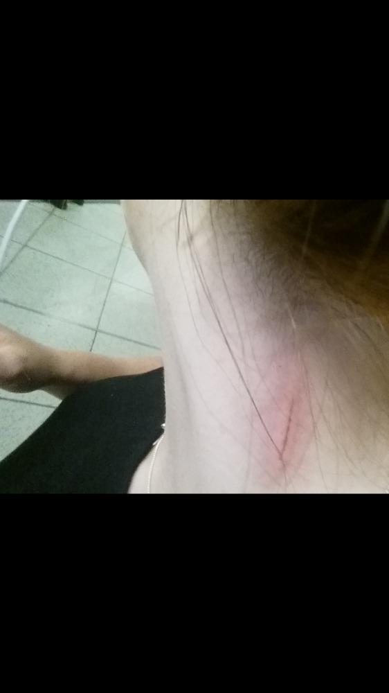 AnnaHilley's tweet photo. @TfL this was the result! #TFaiL #ouch http://t.co/HXne18An6B