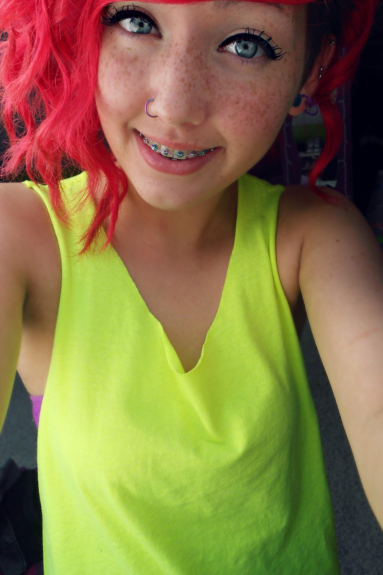 Ο χρήστης Girls With Braces στο Twitter: "Cute Freckles #braces http:/...