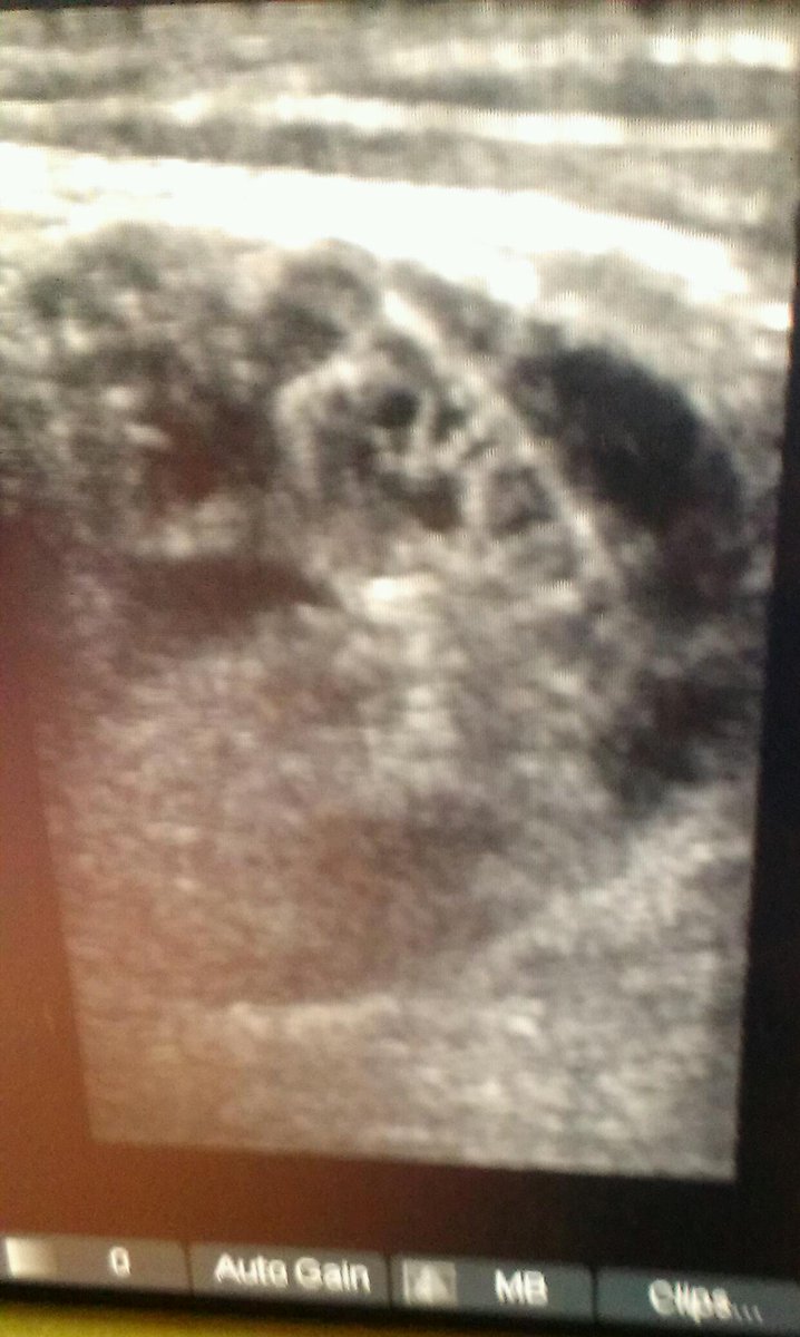 @davebakerphysio tweet media