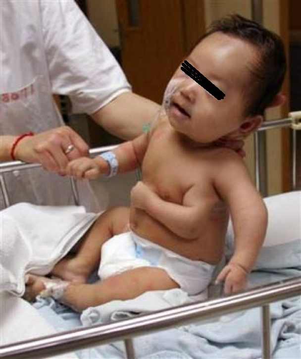 Hiroyuki Watanabe 現在の福島 奇形児出産 の割合が極めて高い 福島の とある病院 妊婦の８０ が奇形児出産 Http T Co Uvhqchkpaw Http T Co Bqndzvweyz