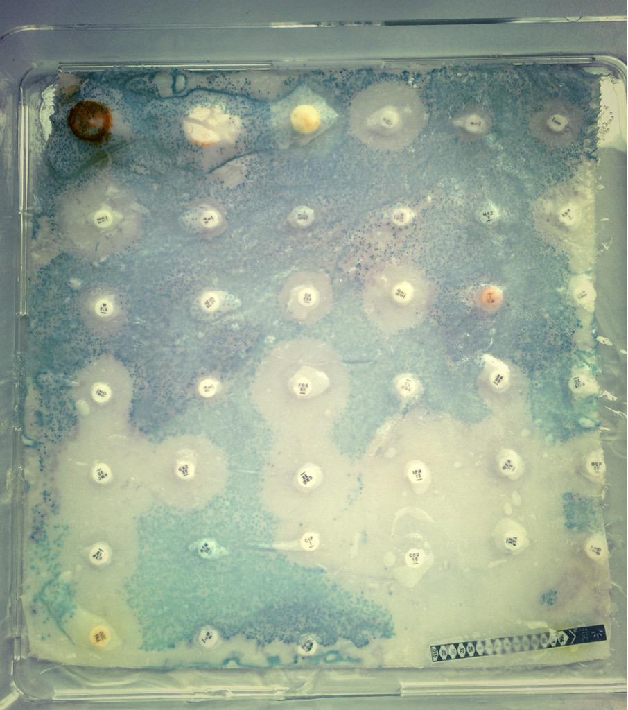 DrNJFawcett's tweet photo. Gut microbiome #antibiotic timeline on silk #bioart with @AnnaDumitriu @ModMedMicro #CarbapenemCorner #mostlycorrect http://t.co/nbnTMIZJva